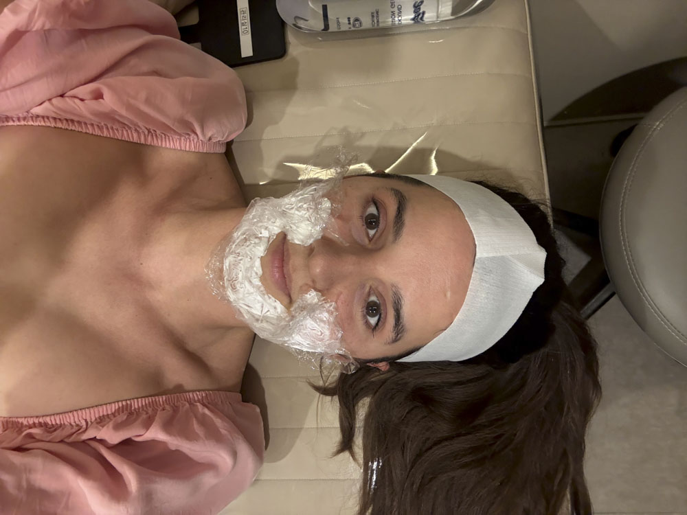 numbing cream